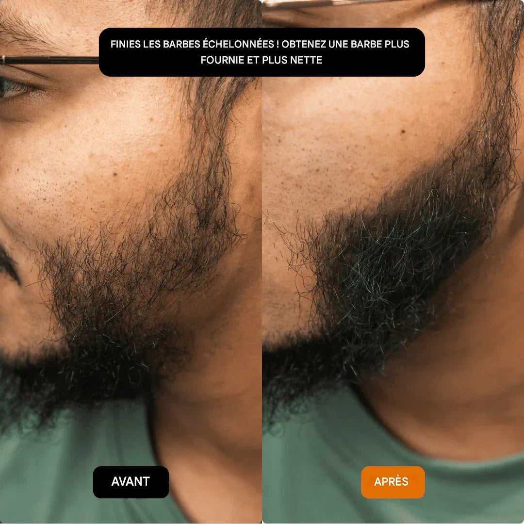 GROWY™ Poudre capillaire - Achetez-en 1 et recevez-en 2